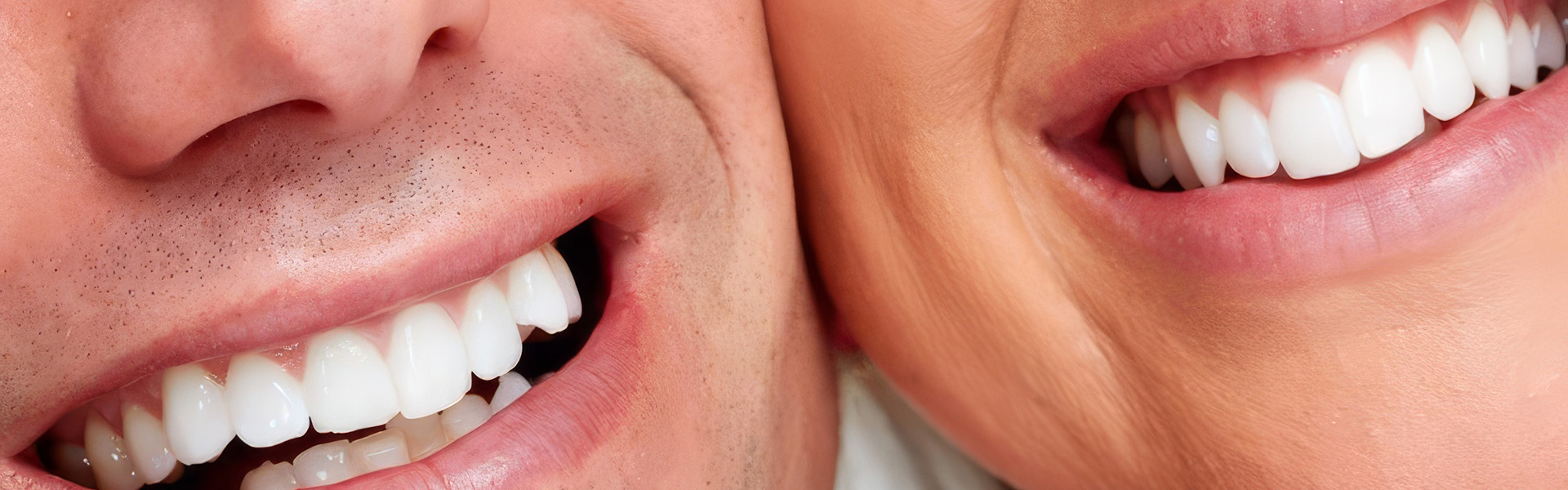 Scale and Polish - CK Dental Health Clinic Dentist surgery Bishops Stortford